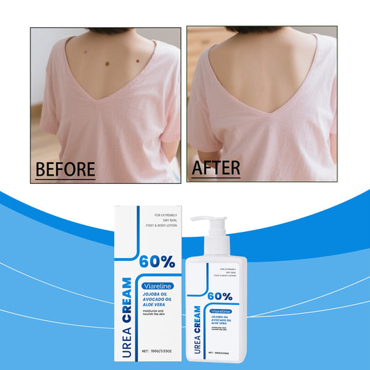 Urea Body Lotion