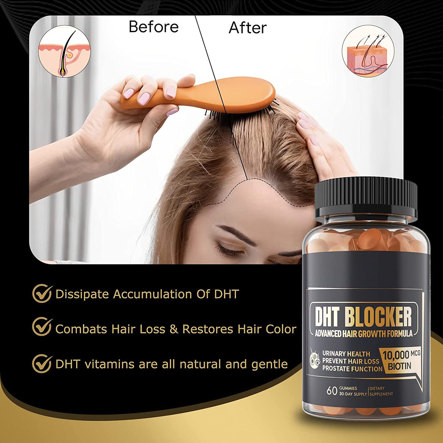 Blocking Agent Soft Candy Hair 60 Capsules DHT Soft Candy