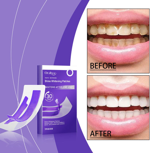 Whitening And Stain-Removing Teeth Strips