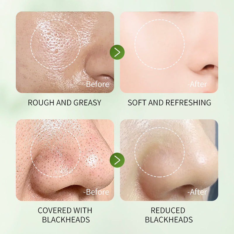 HUNMUI Mugwort Plant Extract Clay Mask Stick 40g