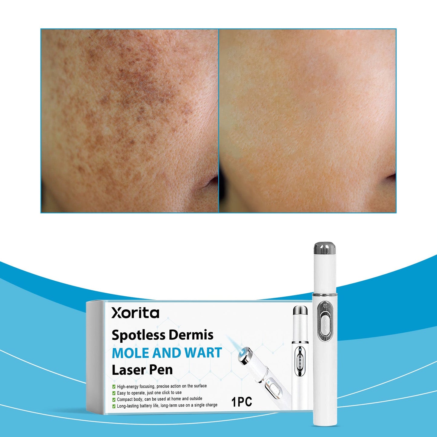 Skin Care Laser Pen 1pc