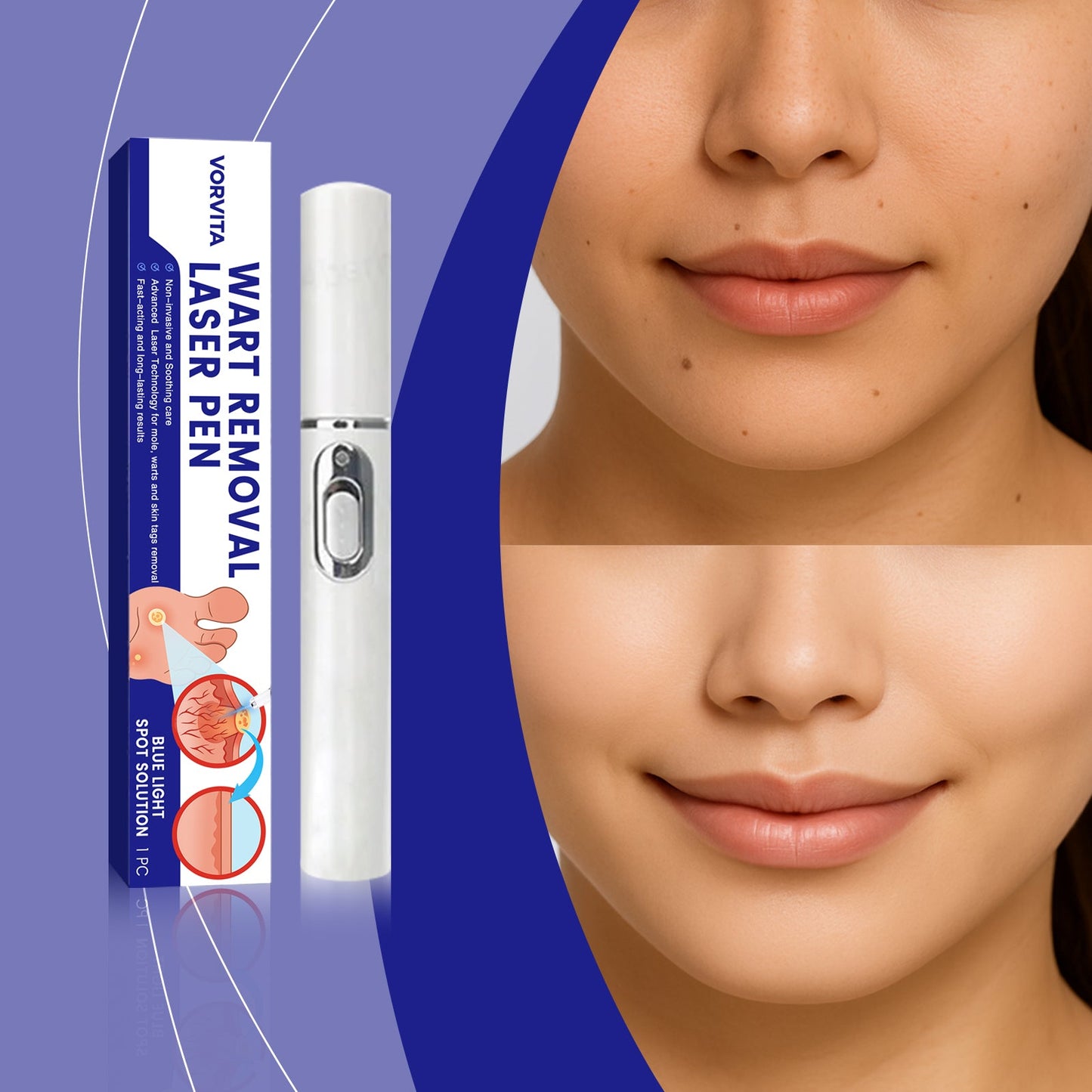 Skin Laser Care Pen 1pc