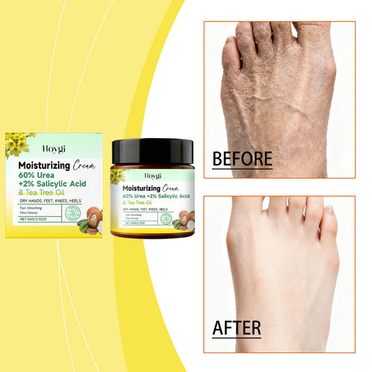 Urea Hand And Foot Moisturizing Cream