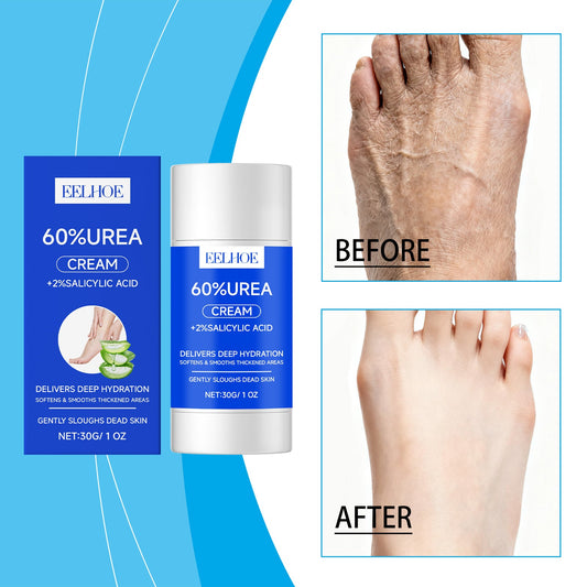 Urea Foot Care Stick
