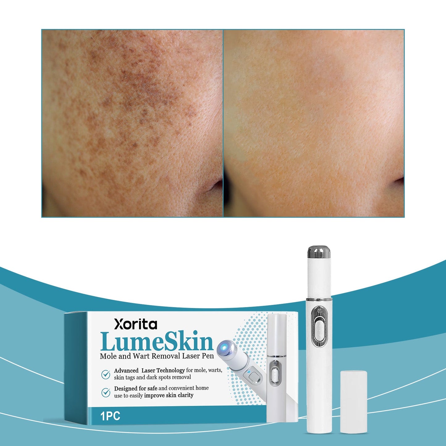 Skin Care Laser Pen 1pc