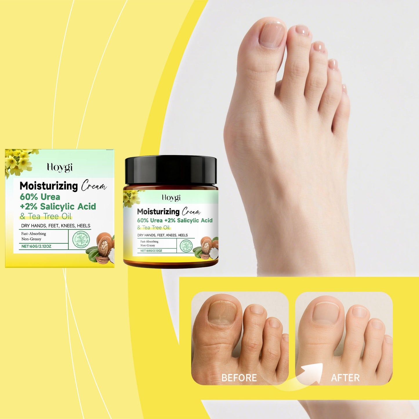 Urea Hand And Foot Moisturizing Cream