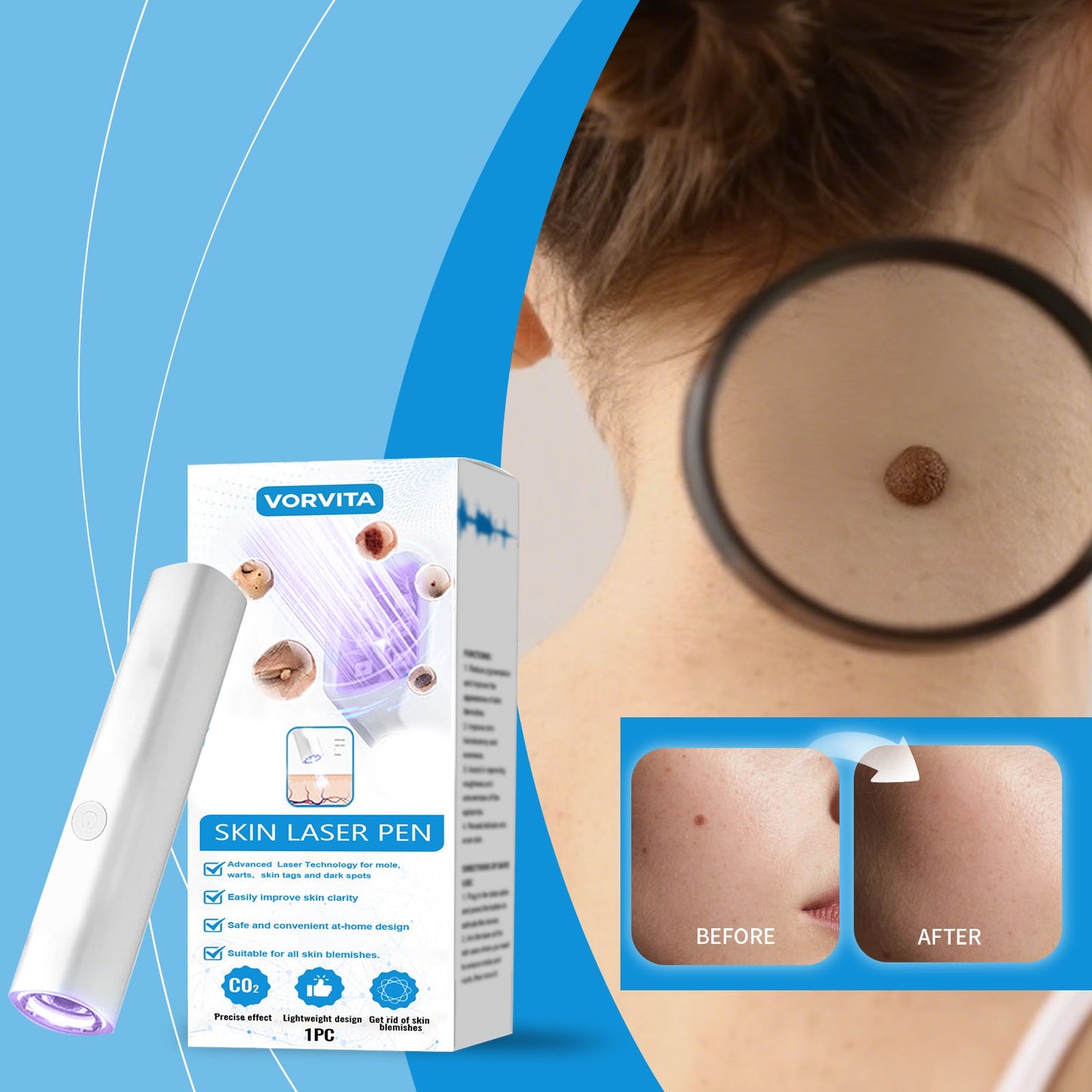 Skin Laser Pen 1pc