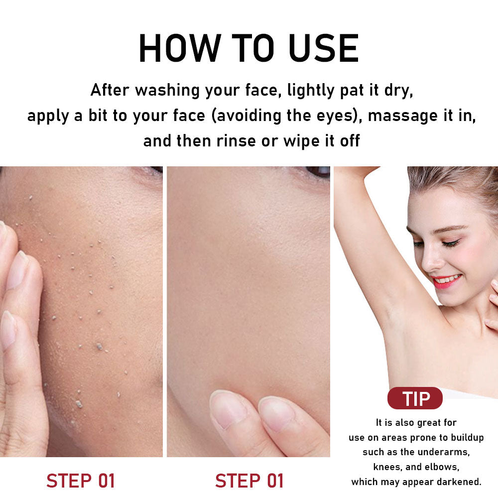 Phofay Gentle Peeling Solution – Papaya Enzyme AHA BHA